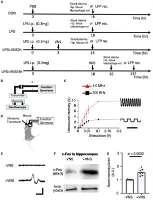 Ultrasound stimulation of the vagal nerve improves acute septic encephalopathy in mice